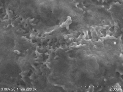 Capillary-bile-duct-conductive-staining